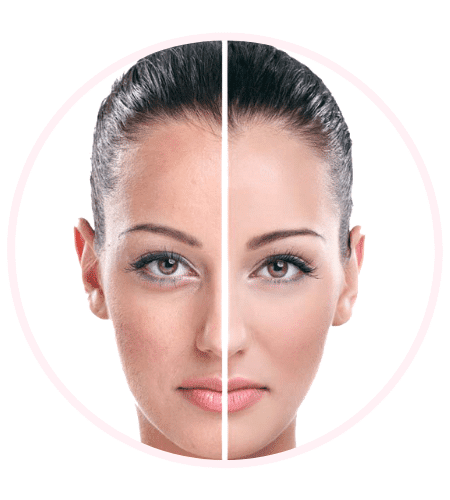 טיפול פנים - לפני ואחרי