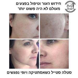 טיפול פנים לחידוש העור